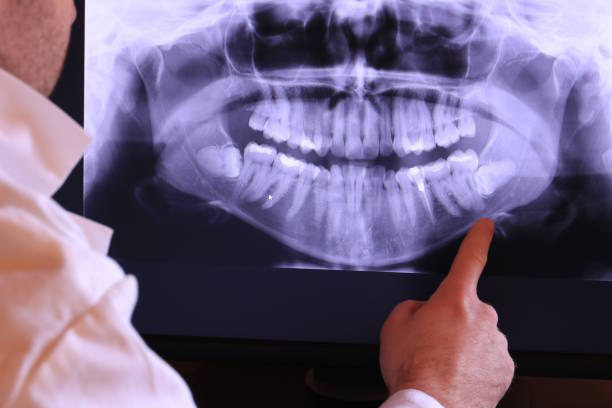Best Emergency Treatment for Dental Infections or Abscesses in West Glendive, MT