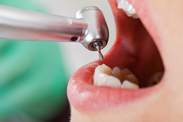Best Emergency TMJ Treatment in West Glendive, MT